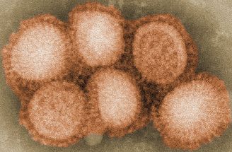 Ispaniškasis gripas H1N1